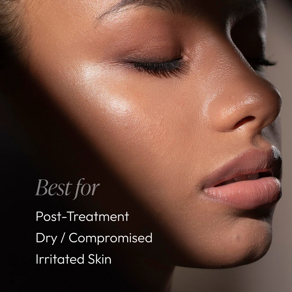 Post Treatment Balm